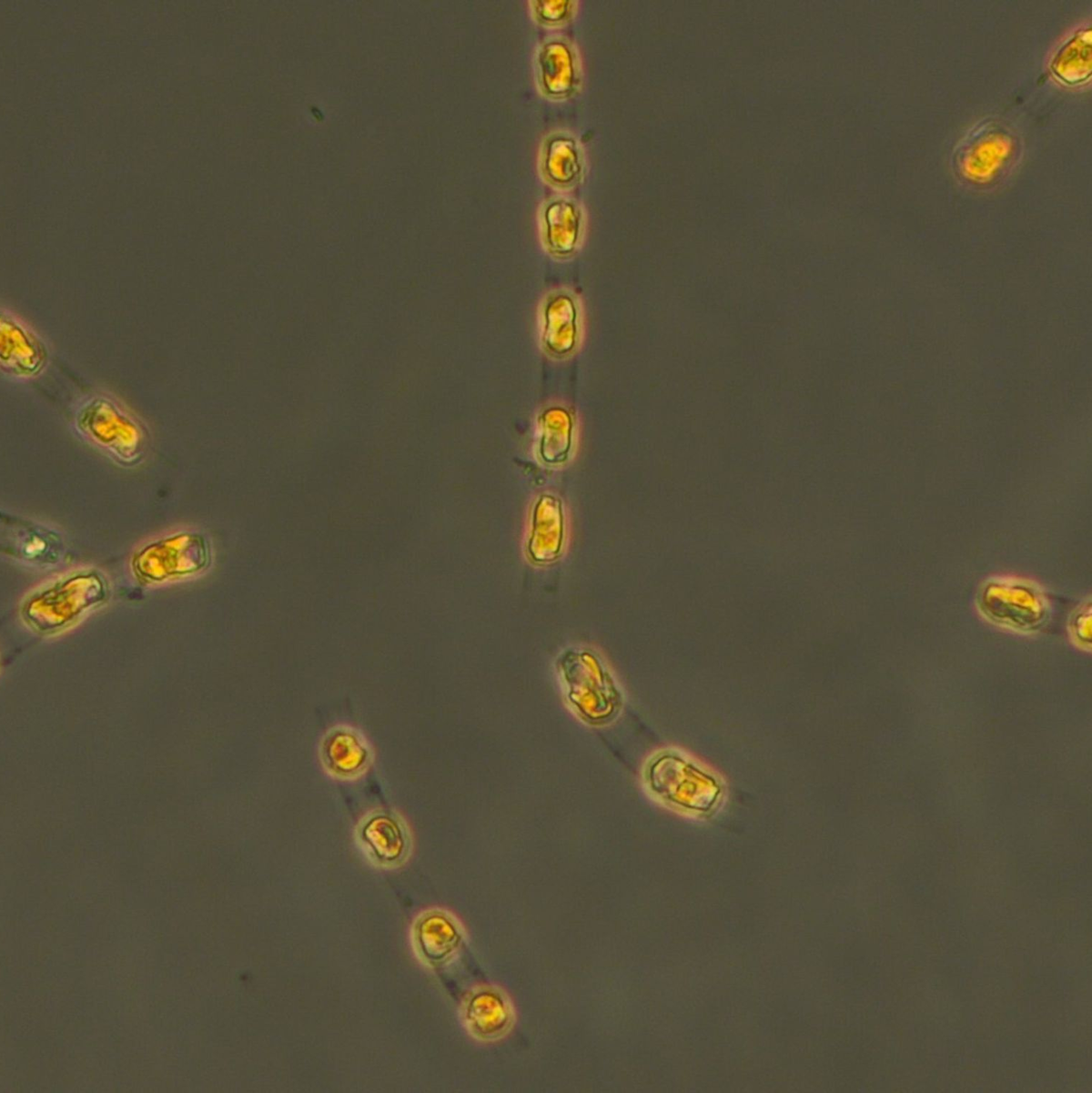 Die Kieselalge Skeletonema marinoi ist nach 7000 Jahren in einem Dauerzustand auf dem Meeresgrund nun wieder aktiv.  - Foto: S. Bolius/Iow/dpa