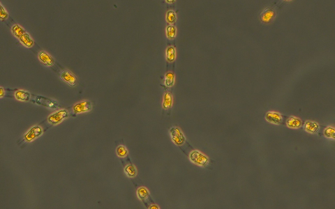 Die Kieselalge Skeletonema marinoi ist nach 7000 Jahren in einem Dauerzustand auf dem Meeresgrund nun wieder aktiv.  - Foto: S. Bolius/Iow/dpa