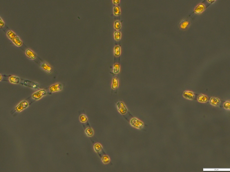 Die Kieselalge Skeletonema marinoi ist nach 7000 Jahren in einem Dauerzustand auf dem Meeresgrund nun wieder aktiv.  - Foto: S. Bolius/Iow/dpa