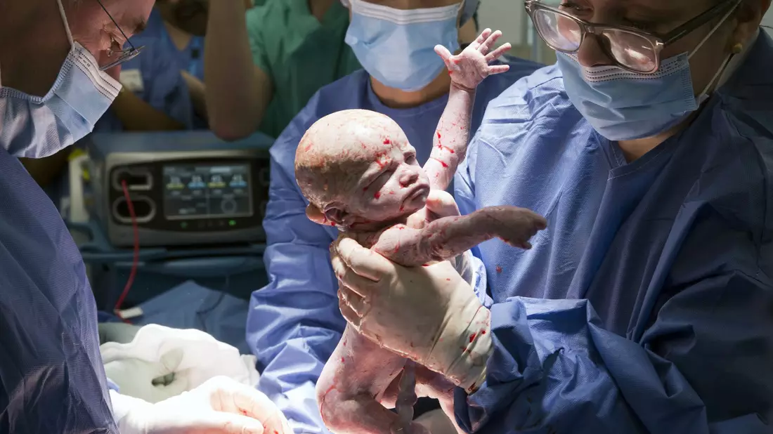 Es soll der erste solche Fall in Großbritannien gewesen sein. - Bild: Womb Transplant Uk/PA Media/dpa
