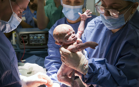 Es soll der erste solche Fall in Großbritannien gewesen sein. - Foto: Womb Transplant Uk/PA Media/dpa