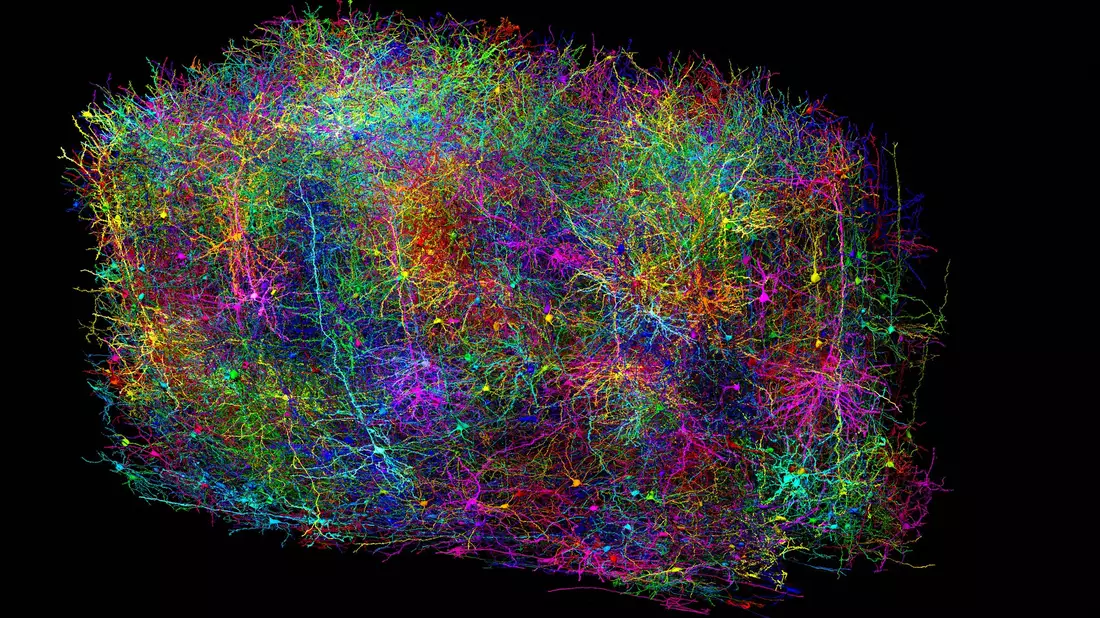 Diese Illustration zeigt eine hemmend wirkende Zelle. Die Kontaktstellen zu anderen Nervenzellen (helle Punkte) sind nach dem Typ der Zielzelle farblich kodiert. - Bild: Clare Gamlin/Allen Institute/dpa