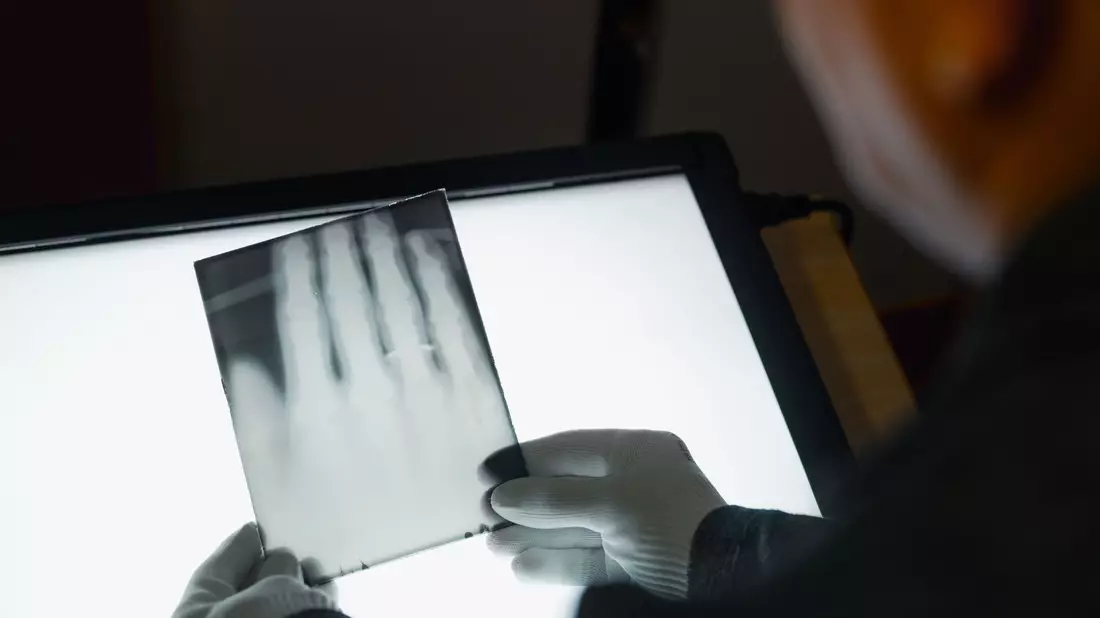 Ein Röntgenbild der Hand von Wilhelm Röntgen gehört nun zum  Unesco-Weltdokumentenerbe. (Archivbild) - Bild: Marius Becker/dpa