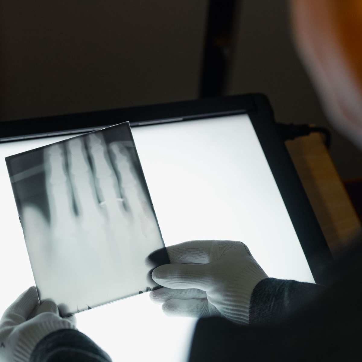 Ein Röntgenbild der Hand von Wilhelm Röntgen gehört nun zum  Unesco-Weltdokumentenerbe. (Archivbild) - Foto: Marius Becker/dpa