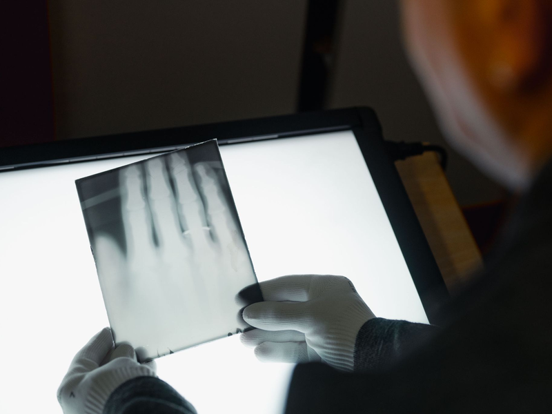 Ein Röntgenbild der Hand von Wilhelm Röntgen gehört nun zum  Unesco-Weltdokumentenerbe. (Archivbild) - Foto: Marius Becker/dpa