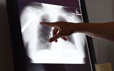 Gutachter überprüfen Behandlungen im Nachhinein auf Fehler (Foto: Archiv). - Foto: Susann Prautsch/dpa/dpa-tmn