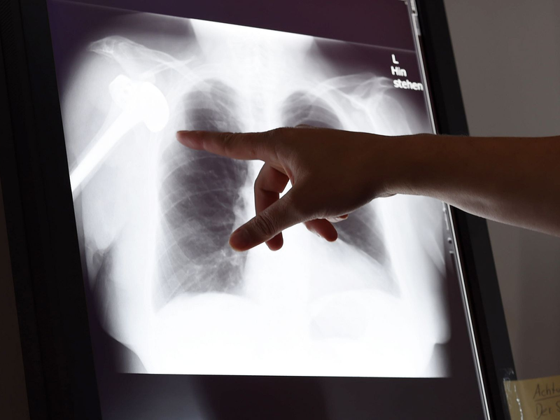 Gutachter überprüfen Behandlungen im Nachhinein auf Fehler (Foto: Archiv). - Foto: Susann Prautsch/dpa/dpa-tmn