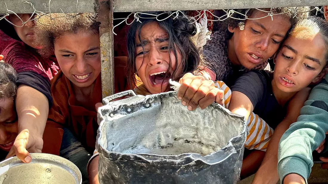 Unicef warnt vor den fatalen Folgen der zunehmenden Mangelernährung von Kindern im Gazastreifen. Die Jüngsten gerieten durch Hunger und Krankheiten in einen Teufelskreis. - Bild: Moaz Abu Taha/APA Images via ZUMA Press Wire/dpa