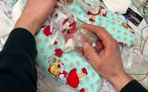 Etwas mehr als ein Päckchen Butter wog die kleine Marie, als sie im Februar zur Welt kam. Seitdem ist das Kind gut gewachsen. - Foto: Privat/Kinderklinik Dritter Orden Passau/dpa