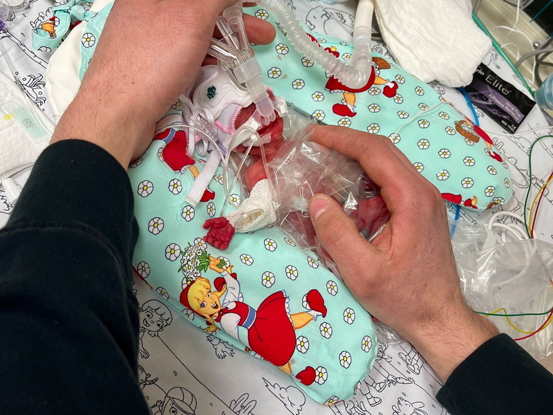 Etwas mehr als ein Päckchen Butter wog die kleine Marie, als sie im Februar zur Welt kam. Seitdem ist das Kind gut gewachsen. - Foto: Privat/Kinderklinik Dritter Orden Passau/dpa