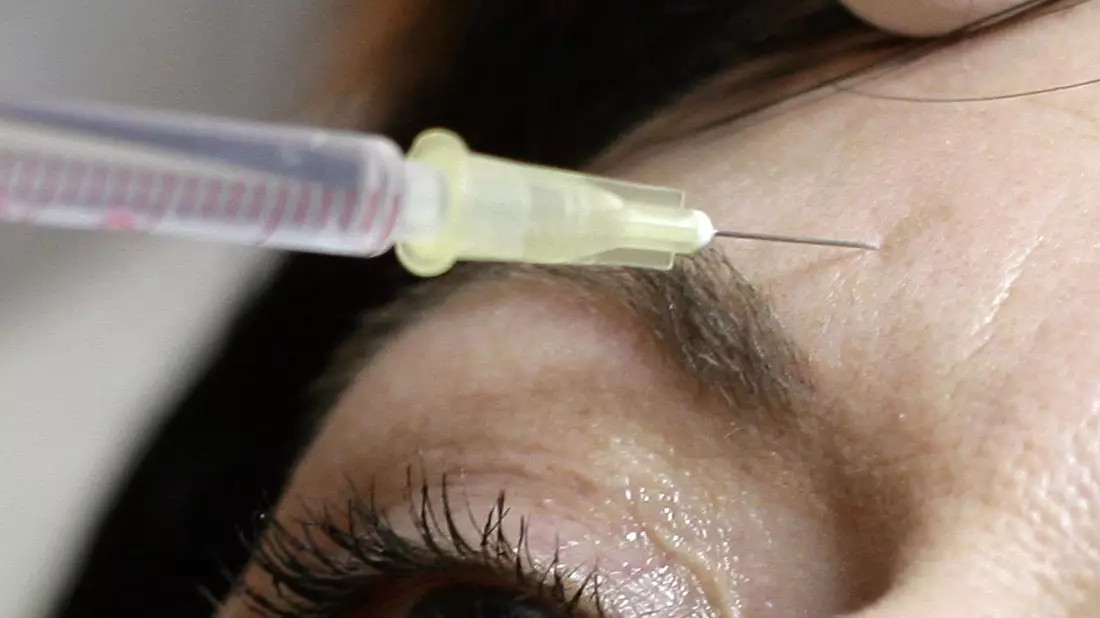 Am BGH geht es um sogenannte minimalinvasive Schönheitsbehandlungen. (Symbolbild) - Bild: Peer Grimm/dpa-Zentralbild/dpa