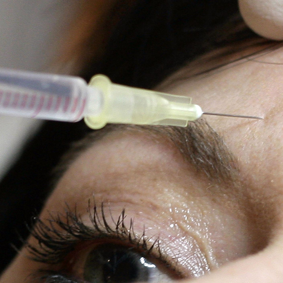 Am BGH geht es um sogenannte minimalinvasive Schönheitsbehandlungen. (Symbolbild) - Foto: Peer Grimm/dpa-Zentralbild/dpa