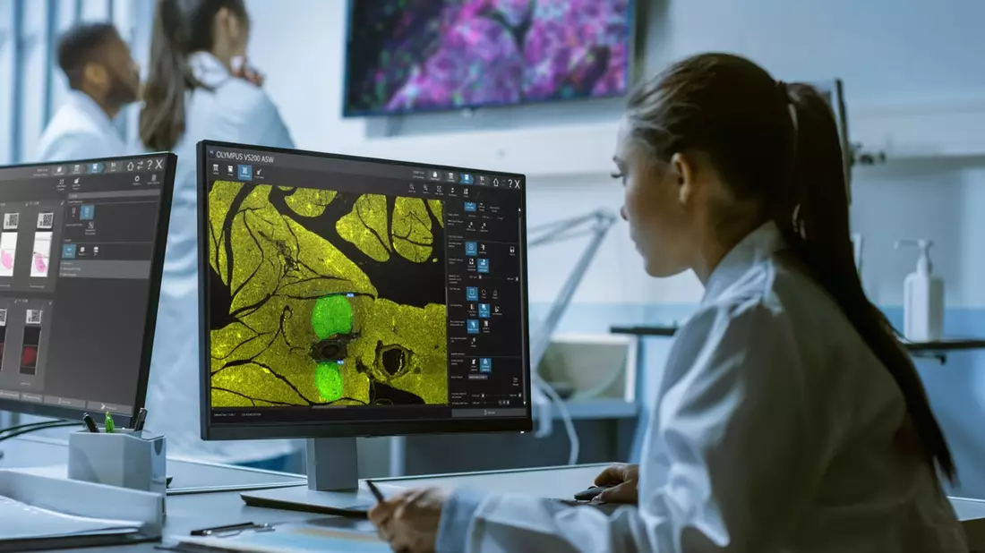 Ein klarerer Blick: Digitale Werkzeuge für die moderne Pathologie - Bild: presseportal.de