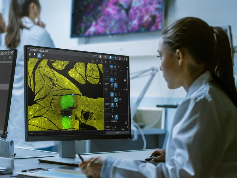 Ein klarerer Blick: Digitale Werkzeuge für die moderne Pathologie - Foto: presseportal.de