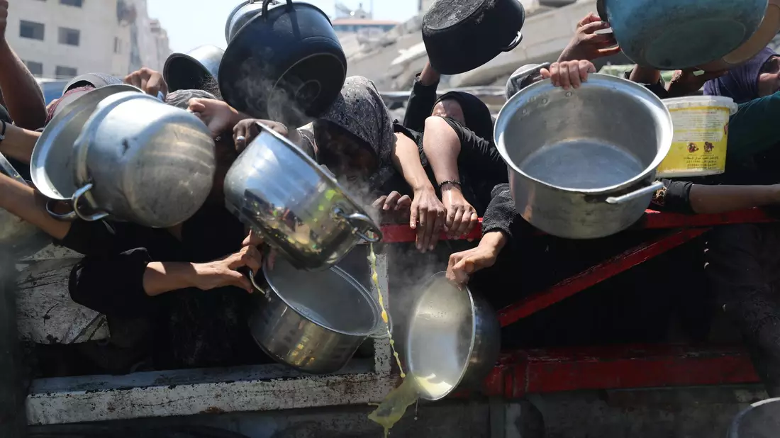 Viele Kinder im Gazastreifen leiden an Unterernährung. (Archivbild) - Bild: Omar Ashtawy/APA Images via ZUMA Press Wire/dpa