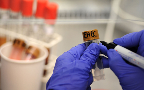 Rinder-Salami wird wegen einer möglichen bakteriellen Belastung zurückgerufen. (Symbolbild)  - Foto: picture alliance / dpa