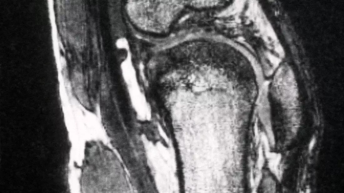 Schmerzen im Knie treiben viele Versicherte zum Orthopäden - viele kommen dort mit fragwürdigen Therapien in Kontakt. (Archivbild) - Bild: picture alliance / dpa