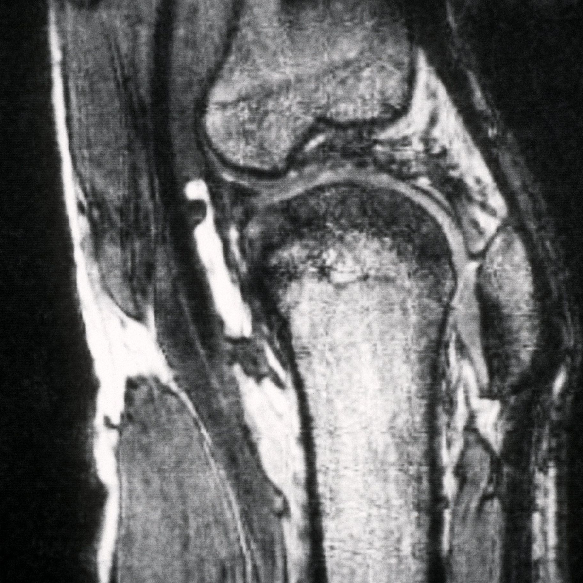 Schmerzen im Knie treiben viele Versicherte zum Orthopäden - viele kommen dort mit fragwürdigen Therapien in Kontakt. (Archivbild) - Foto: picture alliance / dpa