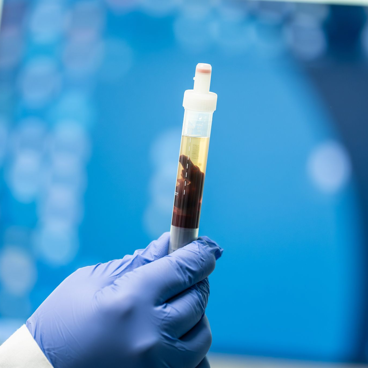 In Kalifornien konnte eine Pest-Infektion nachgewiesen werden - Foto: Silas Stein/dpa