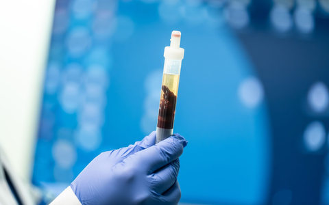 In Kalifornien konnte eine Pest-Infektion nachgewiesen werden - Foto: Silas Stein/dpa