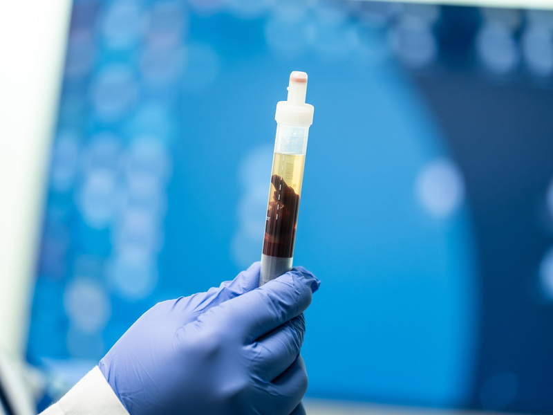 In Kalifornien konnte eine Pest-Infektion nachgewiesen werden - Foto: Silas Stein/dpa