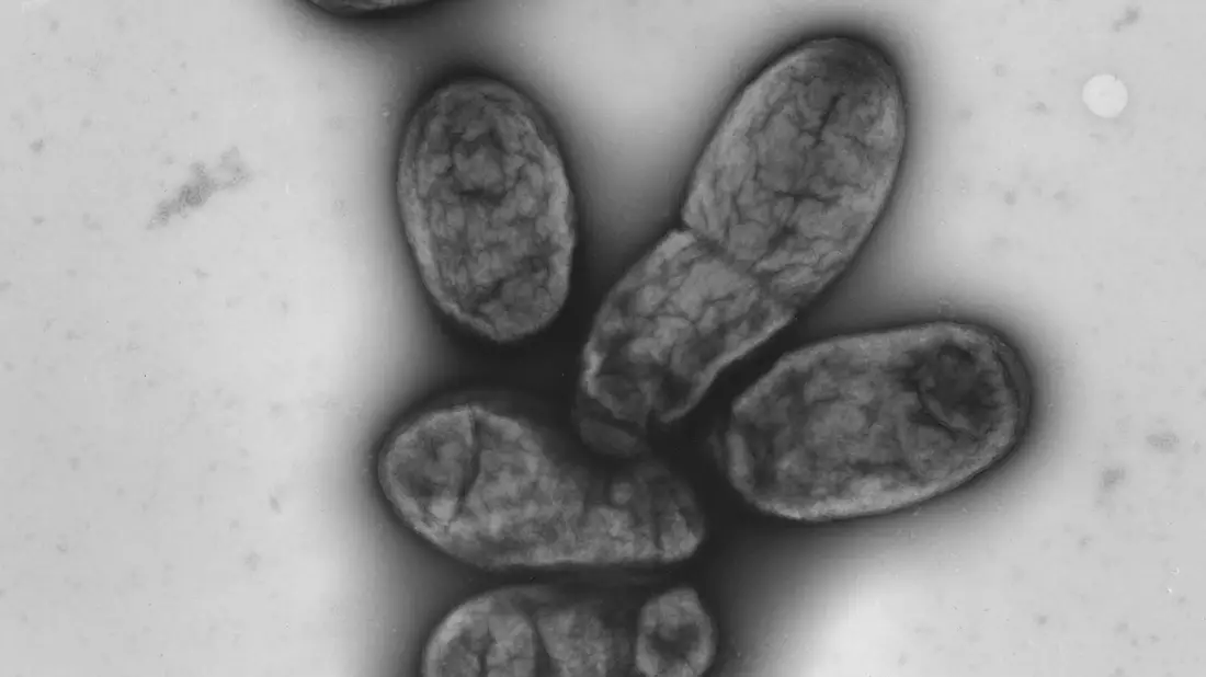 Das Pestbakterium Yersinia pestis - Bild: picture alliance / dpa