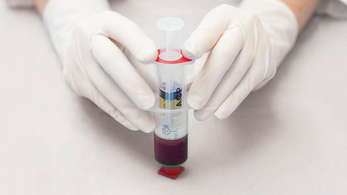 Bioregenerative Therapie von Arthrosen und Sportverletzungen - Mit ACP aus dem eigenen Blut direkt in Gelenke, Muskeln oder Sehnen - Foto: presseportal.de