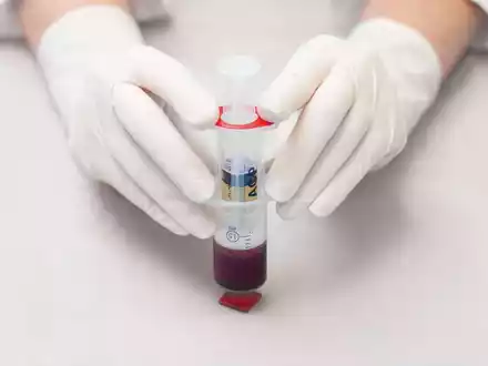 Bioregenerative Therapie von Arthrosen und Sportverletzungen - Mit ACP aus dem eigenen Blut direkt in Gelenke, Muskeln oder Sehnen - Foto: presseportal.de