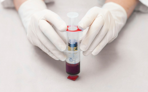 Bioregenerative Therapie von Arthrosen und Sportverletzungen - Mit ACP aus dem eigenen Blut direkt in Gelenke, Muskeln oder Sehnen - Foto: presseportal.de