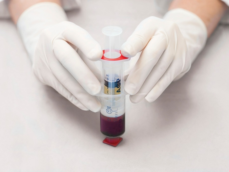 Bioregenerative Therapie von Arthrosen und Sportverletzungen - Mit ACP aus dem eigenen Blut direkt in Gelenke, Muskeln oder Sehnen - Foto: presseportal.de