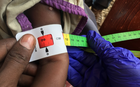 Ein Arzt misst im Sudan den Armumfang eines schwer unterernährten Babys (Archivbild) - Foto: Eva-Maria Krafczyk/dpa