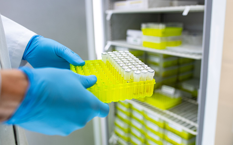 Ehec steht für enterohämorrhagische Escherichia coli und bezeichnet bestimmte krankmachende Stämme dieses im Darm vorkommenden Bakteriums. - Foto: Guido Kirchner/dpa