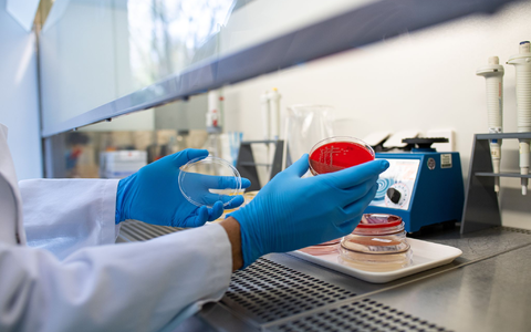 Die Zahl der registrierten Ehec-Infektionen in Mecklenburg-Vorpommern hat sich auf 22 erhöht. (Symbolbild) - Foto: Guido Kirchner/dpa