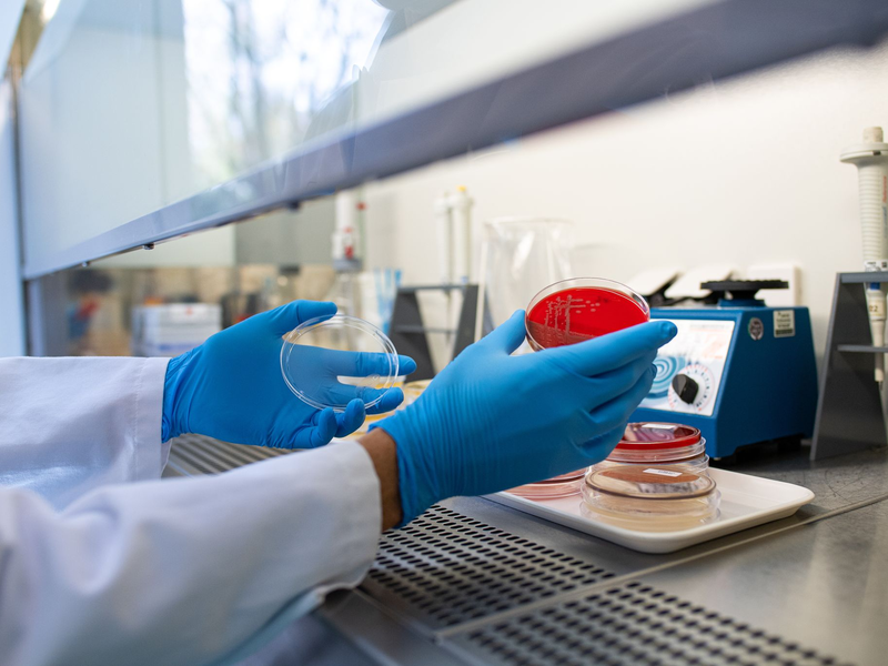 Die Zahl der registrierten Ehec-Infektionen in Mecklenburg-Vorpommern hat sich auf 22 erhöht. (Symbolbild) - Foto: Guido Kirchner/dpa