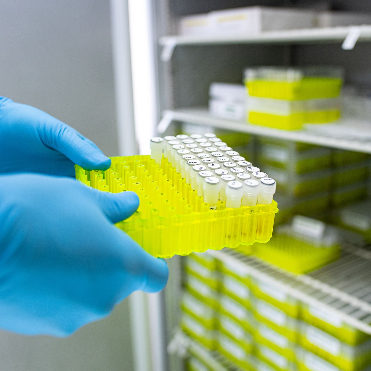 Ehec ist meldepflichtig. (Archivbild) - Foto: Guido Kirchner/dpa