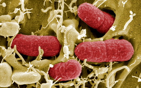 Die Quelle der aktuellen Infektionen ist in keinem der Fälle bekannt. (Archivbild) - Foto: Manfred Rohde/HZI/HZI/dpa Die Quelle der aktuellen Infektionen ist in keinem der Fälle bekannt. (Archivbild) - Foto: Manfred Rohde/HZI/HZI/dpa