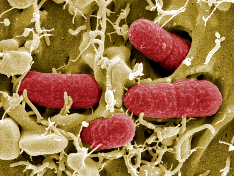 Die Quelle der aktuellen Infektionen ist in keinem der Fälle bekannt. (Archivbild) - Foto: Manfred Rohde/HZI/HZI/dpa