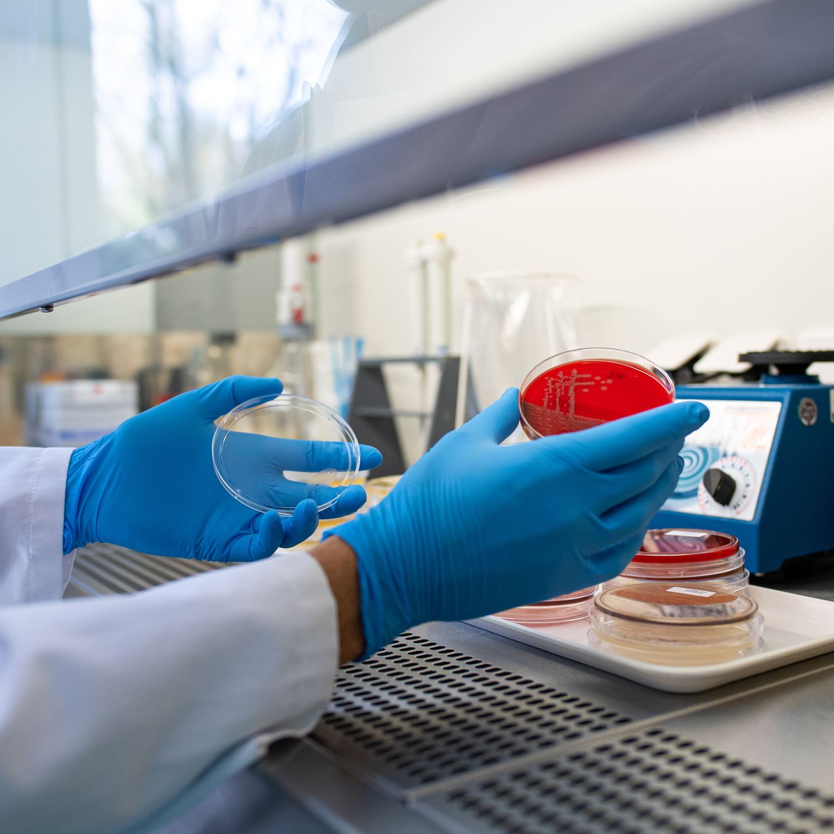 Die Häufung weckt Erinnerungen an einen Ausbruch in Deutschland im Jahr 2011, bei dem rund 3.800 Erkrankungen erfasst wurden und mehr als 50 Menschen starben. (Archivbild) - Foto: Guido Kirchner/dpa