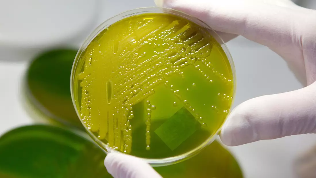 Ehec steht für enterohämorrhagische Escherichia coli und bezeichnet bestimmte krankmachende Stämme des Darm-Bakteriums, die vor allem bei Wiederkäuern wie Rindern vorkommen. (Archivbild) - Bild: Matthias Bein/dpa-Zentralbild/dpa