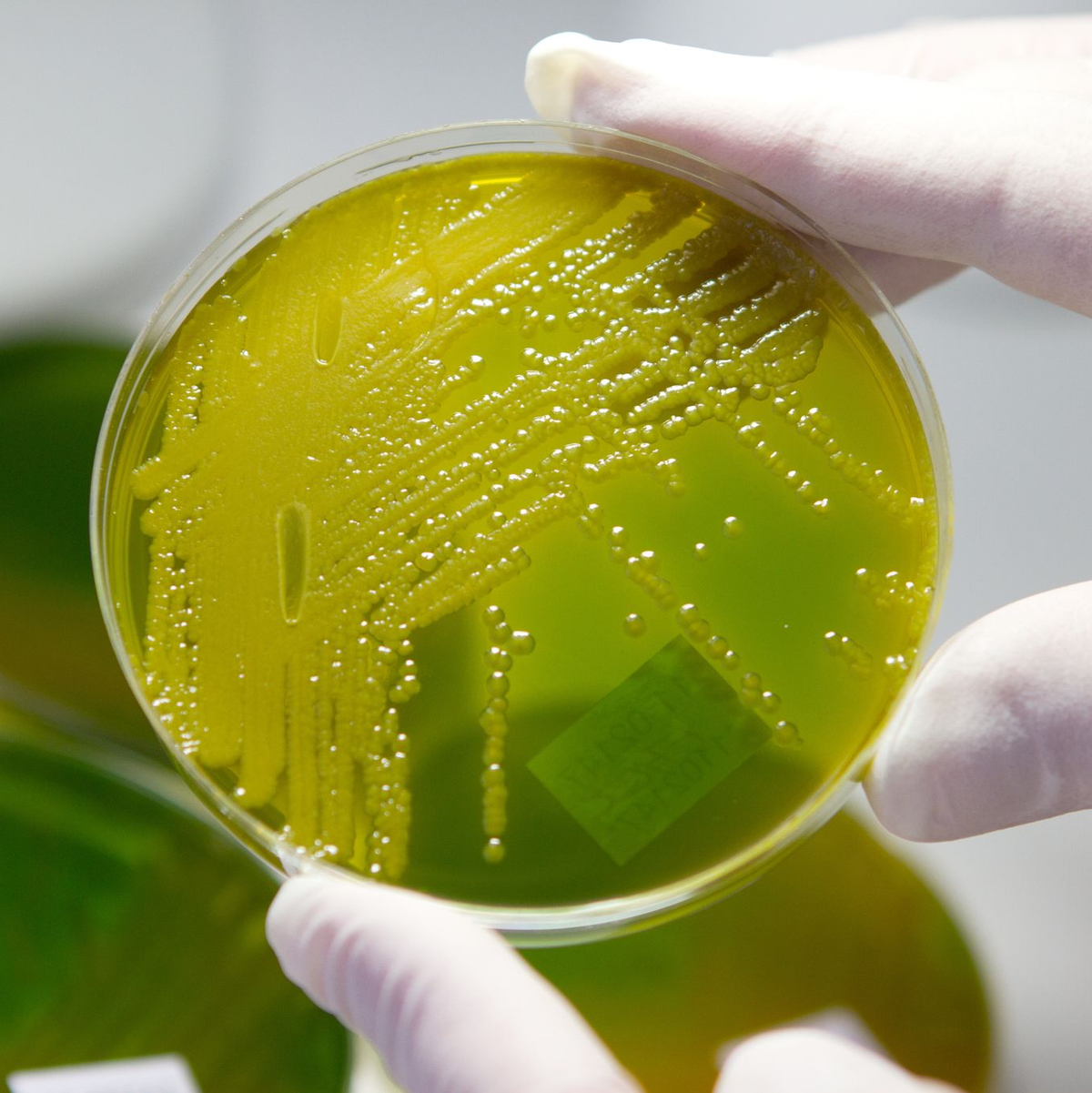 Ehec steht für enterohämorrhagische Escherichia coli und bezeichnet bestimmte krankmachende Stämme des Darm-Bakteriums, die vor allem bei Wiederkäuern wie Rindern vorkommen. (Archivbild) - Foto: Matthias Bein/dpa-Zentralbild/dpa