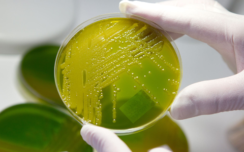In Zwiebelmettwurst wurden die Bakterien nachgewiesen. (Archivbild) - Foto: Matthias Bein/dpa-Zentralbild/dpa In Zwiebelmettwurst wurden die Bakterien nachgewiesen. (Archivbild) - Foto: Matthias Bein/dpa-Zentralbild/dpa