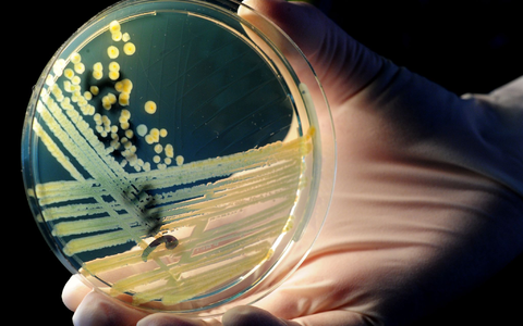 Vom Verzehr eines verunreinigten Lebensmittels bis zum Ausbruch der Erkrankung dauert es im Durchschnitt drei bis vier Tage (Archivbild) - Foto: Julian Stratenschulte/dpa Vom Verzehr eines verunreinigten Lebensmittels bis zum Ausbruch der Erkrankung dauert es im Durchschnitt drei bis vier Tage (Archivbild) - Foto: Julian Stratenschulte/dpa