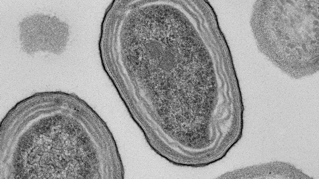 Elektronenmikroskopische Aufnahme von Prochlorococcus-Zellen. - Bild: Natalie Kellogg/dpa