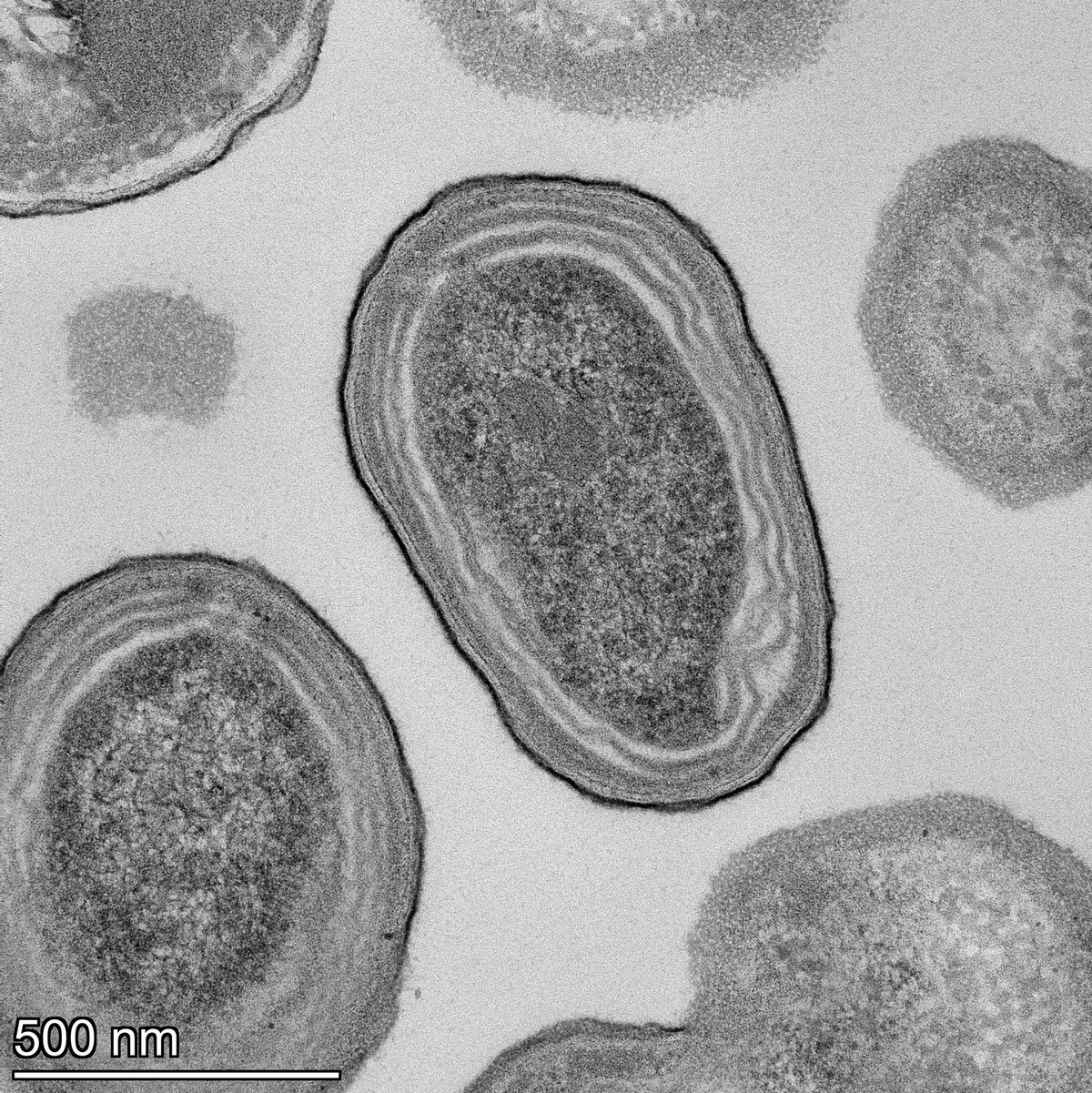 Elektronenmikroskopische Aufnahme von Prochlorococcus-Zellen. - Foto: Natalie Kellogg/dpa