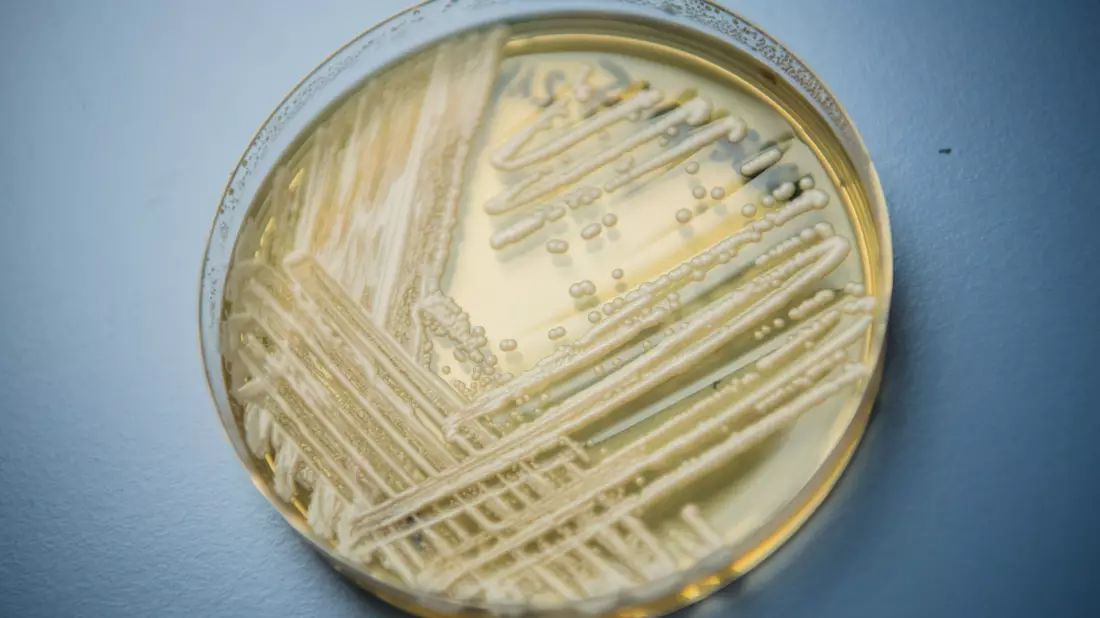 Der Hefepilz Candidozyma auris (früher bekannt als Candida auris). - Bild: Nicolas Armer/dpa