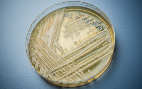 Der Hefepilz Candidozyma auris (früher bekannt als Candida auris). - Foto: Nicolas Armer/dpa