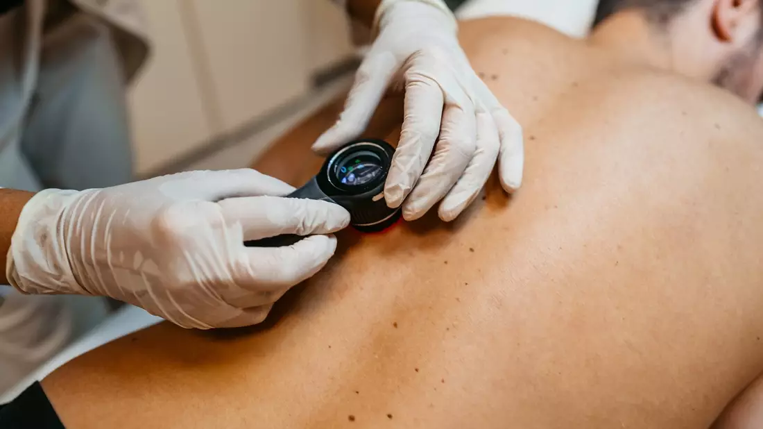 Hautscreening: Neue Möglichkeiten durch KI / Innovative Methoden könnten helfen, die Früherkennung von Hautkrebs weiter zu verbessern. - Bild: presseportal.de