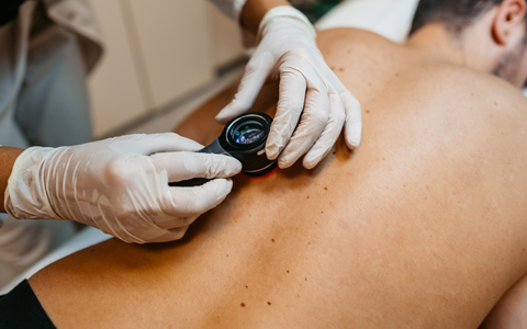 Hautscreening: Neue Möglichkeiten durch KI / Innovative Methoden könnten helfen, die Früherkennung von Hautkrebs weiter zu verbessern. - Foto: presseportal.de