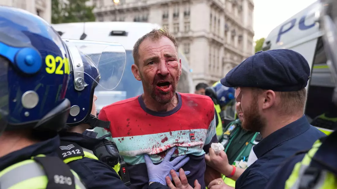 An mehreren Stellen kam es zu Zusammenstößen mit der Polizei.  - Bild: Lucy North/PA Wire/dpa