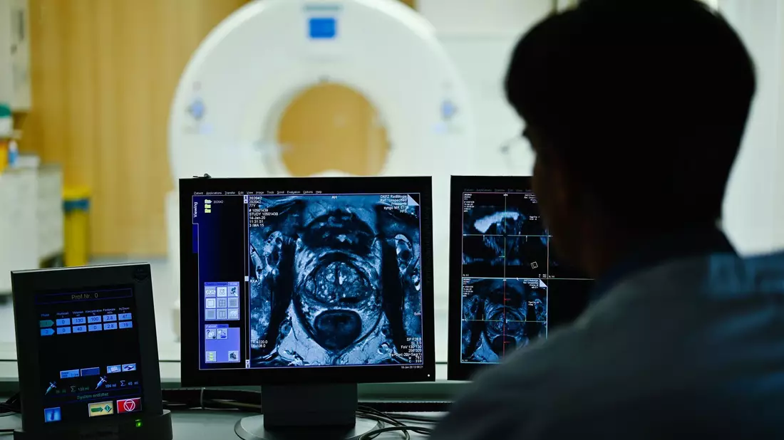 Nach dem Anfangsverdacht auf Prostatakrebs kommen im Verlauf einer Diagnostik auch bildgebende Verfahren zum Einsatz. (Archivbild) - Bild: Uwe Anspach/dpa/dpa-tmn